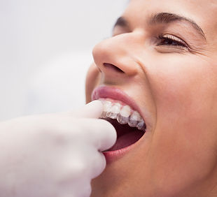 dentista-ajudando-o-paciente-sexo-feminino-usar-aparelho.jpg