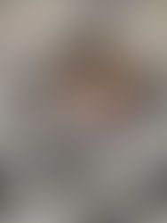 Missy Pupdate after surgery