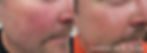 BA6