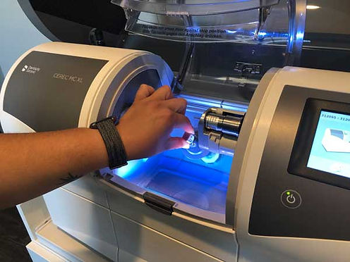 using the cerec same day crowns machine at Crossroads Family Dental located in Schererville Indiana