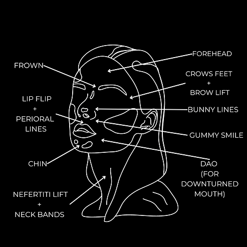 Botox Injections perth, dysport injections perth, wrinkle treatment perth