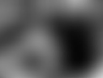 Why One-on-One Matters in Neurological Movement and Recovery