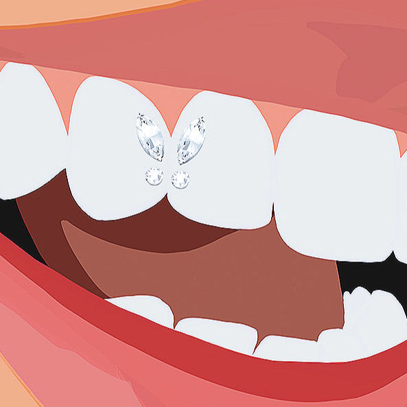 close up of a digital illustration of lips with  tooth gems