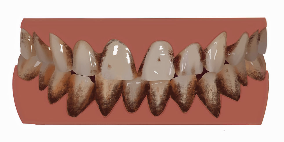 teeth with black tobacco stain