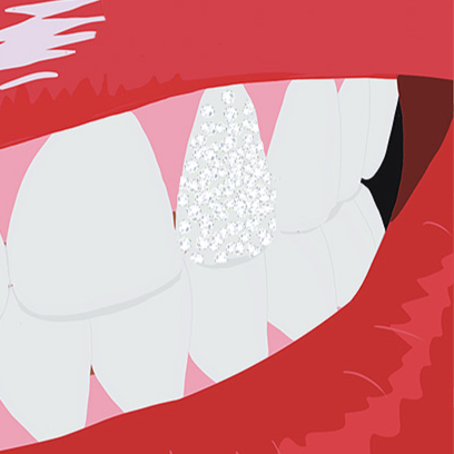 close up of a digital illustration of lips with tooth gems