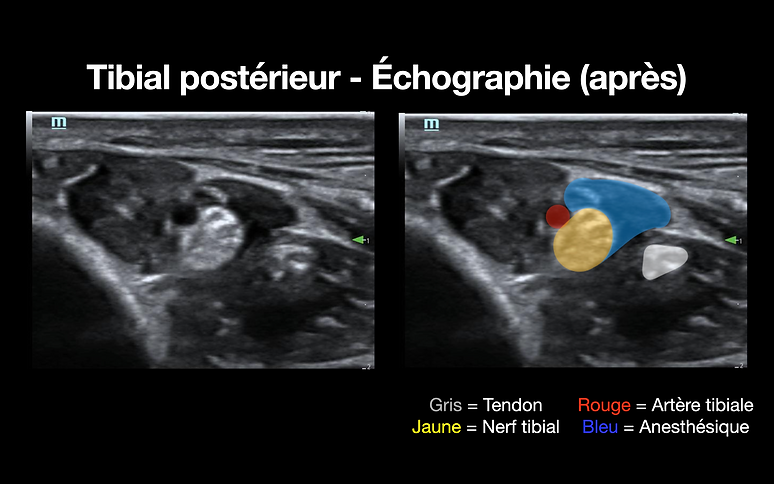 Capture d’écran, le 2023-04-16 à 19.10.28.png