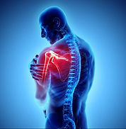 Shoulder Pain