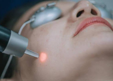 The Top Reasons to Choose Laser Hair Removal Over Other Hair Removal Treatments