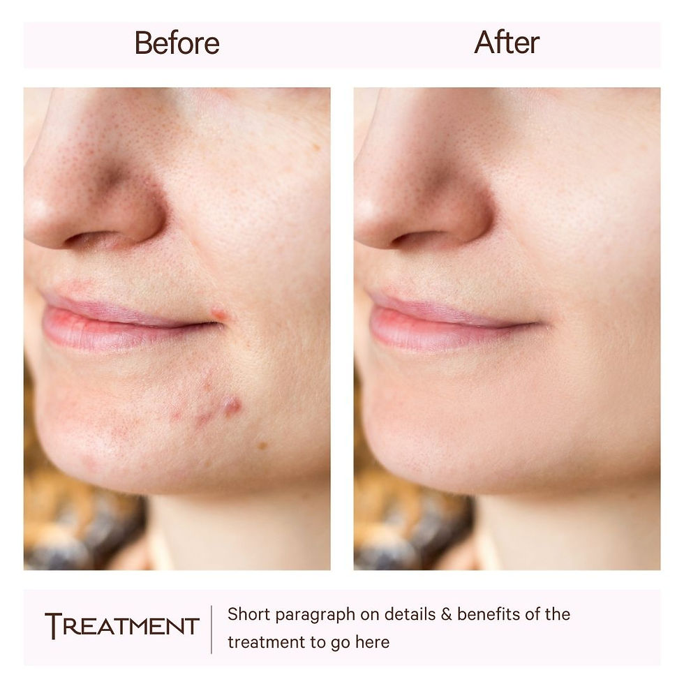 Before & After Graphic