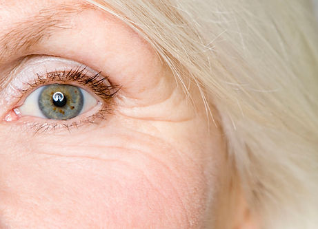 Eye area wrinkles cropped iStock-75403592 05252020 - Copy - Copy (2).jpg