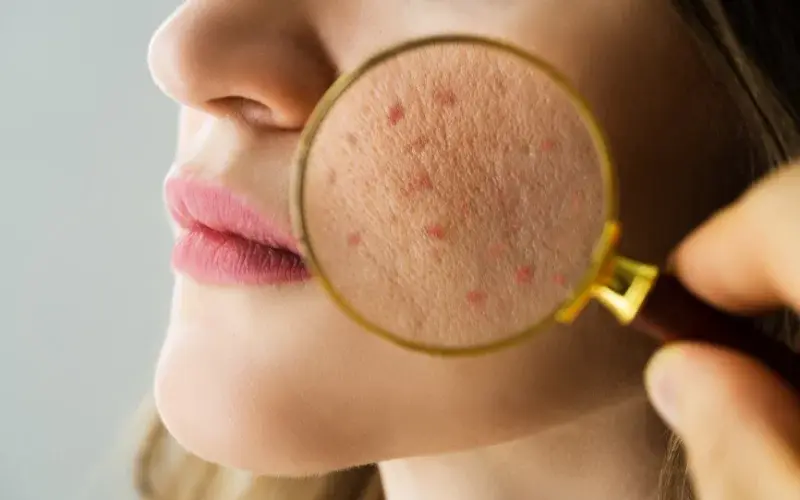 Dermatology.webp
