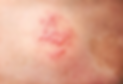 ree