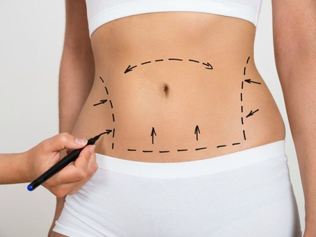 Is Tummy Tuck a Safe Solution for Loose Abdominal Skin