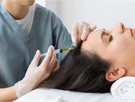 Best PRP Hair Treatment vs Other Methods Which Works Better Safely