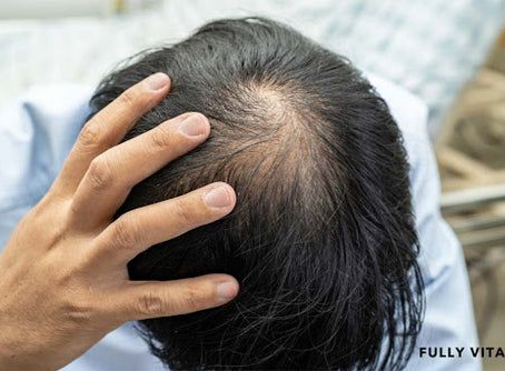 Hair Specialist Doctor Explains the Most Effective Treatment Steps