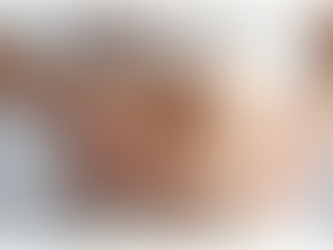 Are Saxenda Injections Right for You Answers to Common Questions