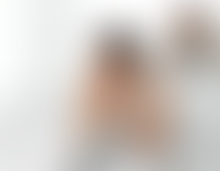 P Shot Treatment Explained What to Expect and How It Works Fast