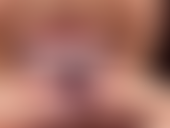 Simple Ways to Estimate Invisalign Braces Treatment Cost Now