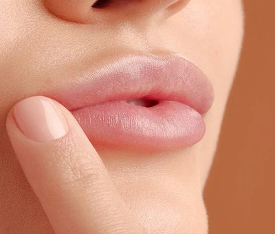 How to Get Soft Pink Lips Fast with Safe Pink Lips Laser Treatment