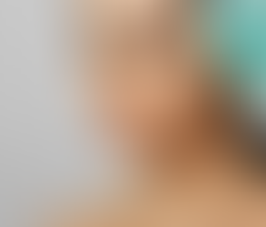 Safe and Effective Botox Treatment for a Refreshed Look