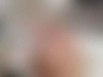 Tighten Skin with HIFU Treatment and Achieve Youthful, Smooth Skin