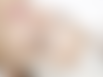 Why Botox Treatment Might Be Your Safest Option for Aging Signs