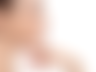 Safe Rhinoplasty Options That Create a More Balanced Facial Look