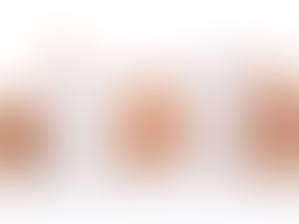 Butt and Body Fillers Guide What to Expect and How They Work