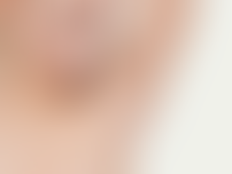 How to Get Smooth Skin Fast with Underarm Whitening Treatment