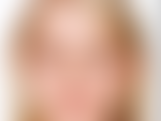 Best Acne Treatment for Acne Scars and Smooth Clear Skin