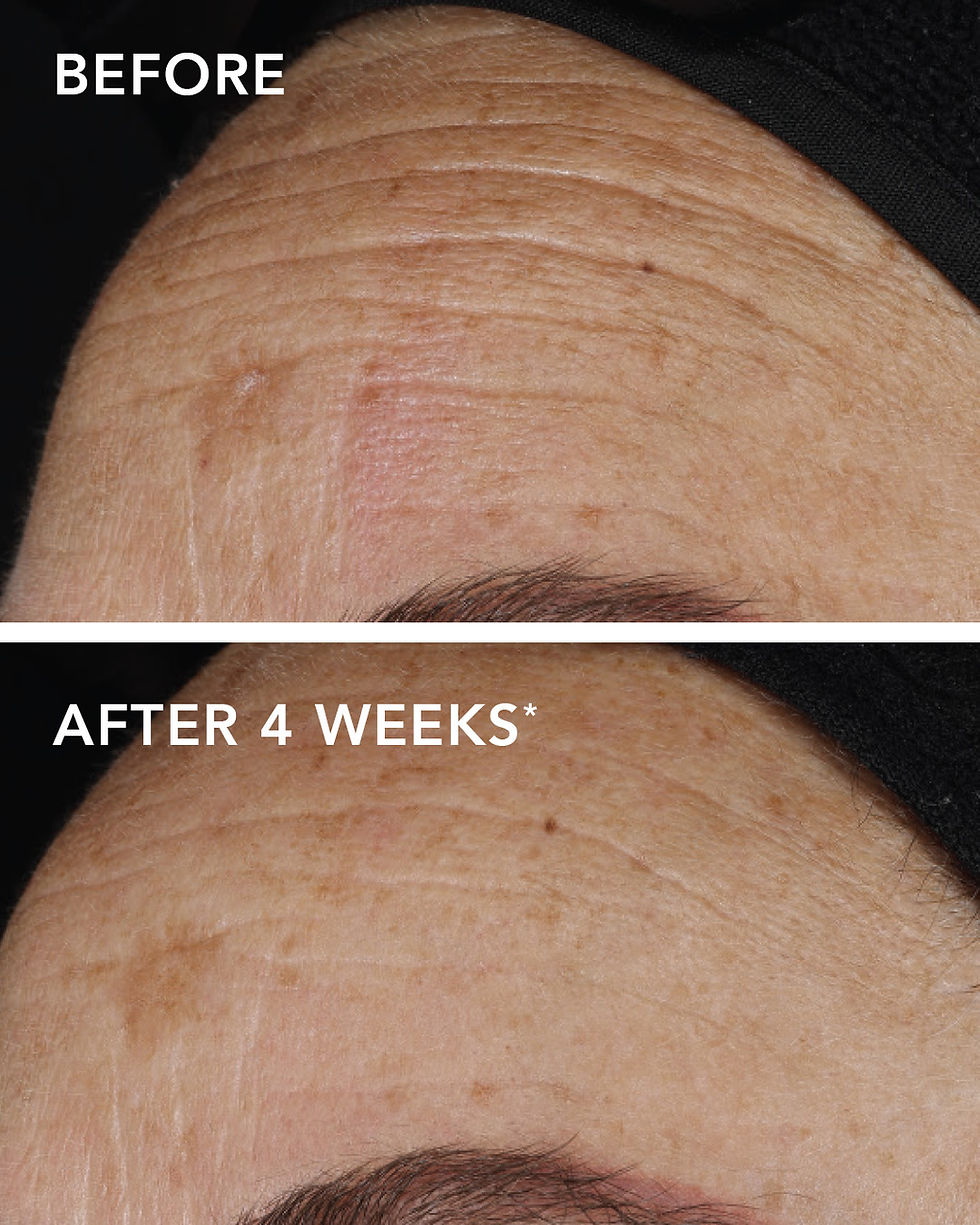 Thumbnail: AGELESS+ retinol pure liquid retinol 0.1%