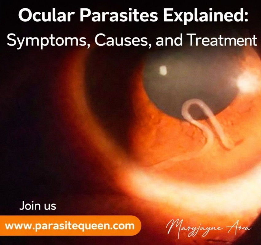 Ocular Parasites: When Worms Invade the Human Eye