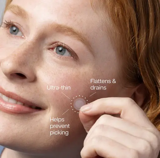 InvisiClear™ Hydrocolloid Spot Patches | Transcendence Skin