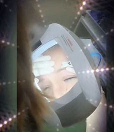 eyebrow treatment