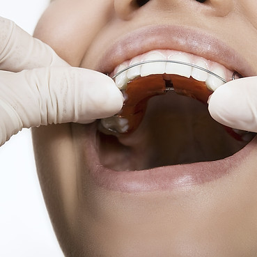orthodontic dentist examining teeth and gums