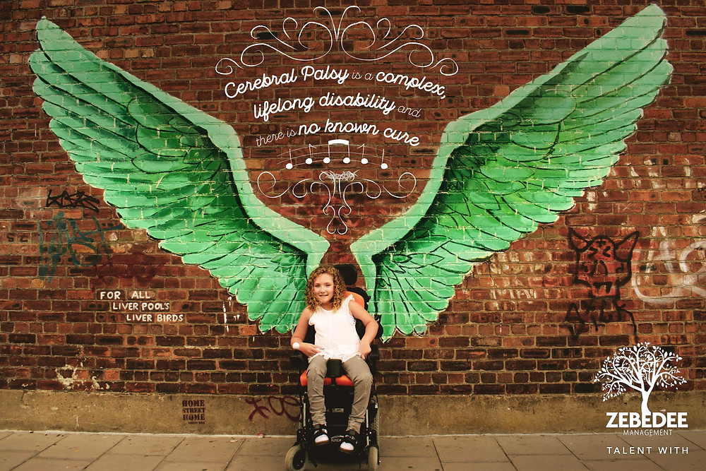 Disabled model photod for world cerebrl palsy awareness day campaign. disability awareness. Zebedee Management differently disabled model agency.