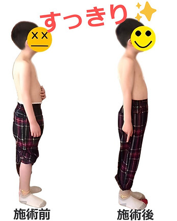 子供の姿勢改善