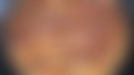 Quiche sans pâte figues/chèvre/bacon/champignons