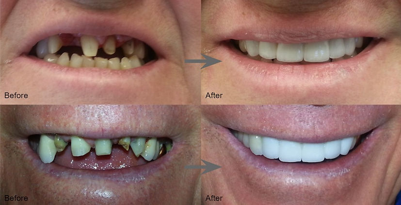 Before and after