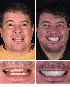 15.png