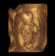 ULTRASONIDO EN TIEMPO REAL