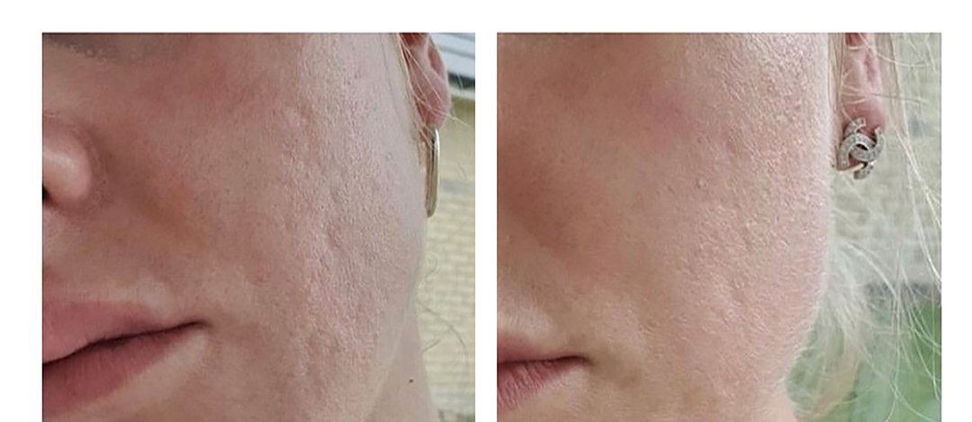 The protocol of treatments is mentioned under each picture