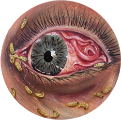 Ocular Filariasis