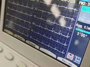 AI models comb patient data to predict cardiac-arrest risk