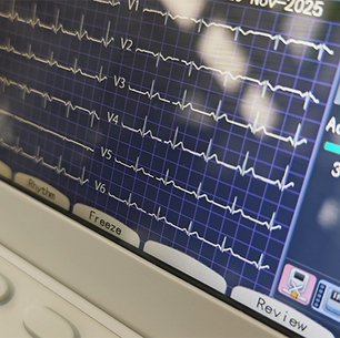 AI models comb patient data to predict cardiac-arrest risk