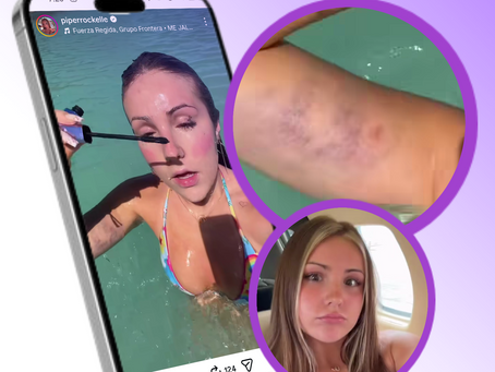 Why Fans Noticed Piper Rockelle’s Arm — And Why Only Fans Insider Magazine Is Talking About It