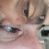 תמונה של WhatsApp 2023-07-09 בשעה 10.23.30.jpg