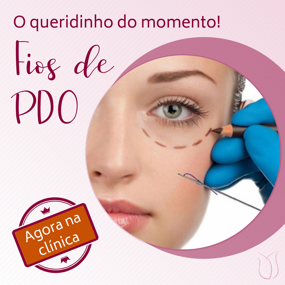 Fios de PDO tem fácil aplicação e pós operatório simples
