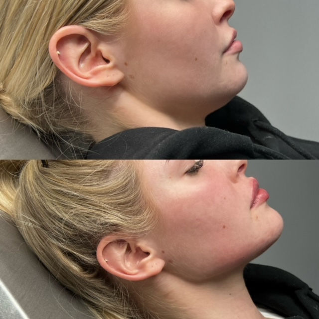 4CF58822-9DB0-4E2B-BFFA-FC0011E751A8