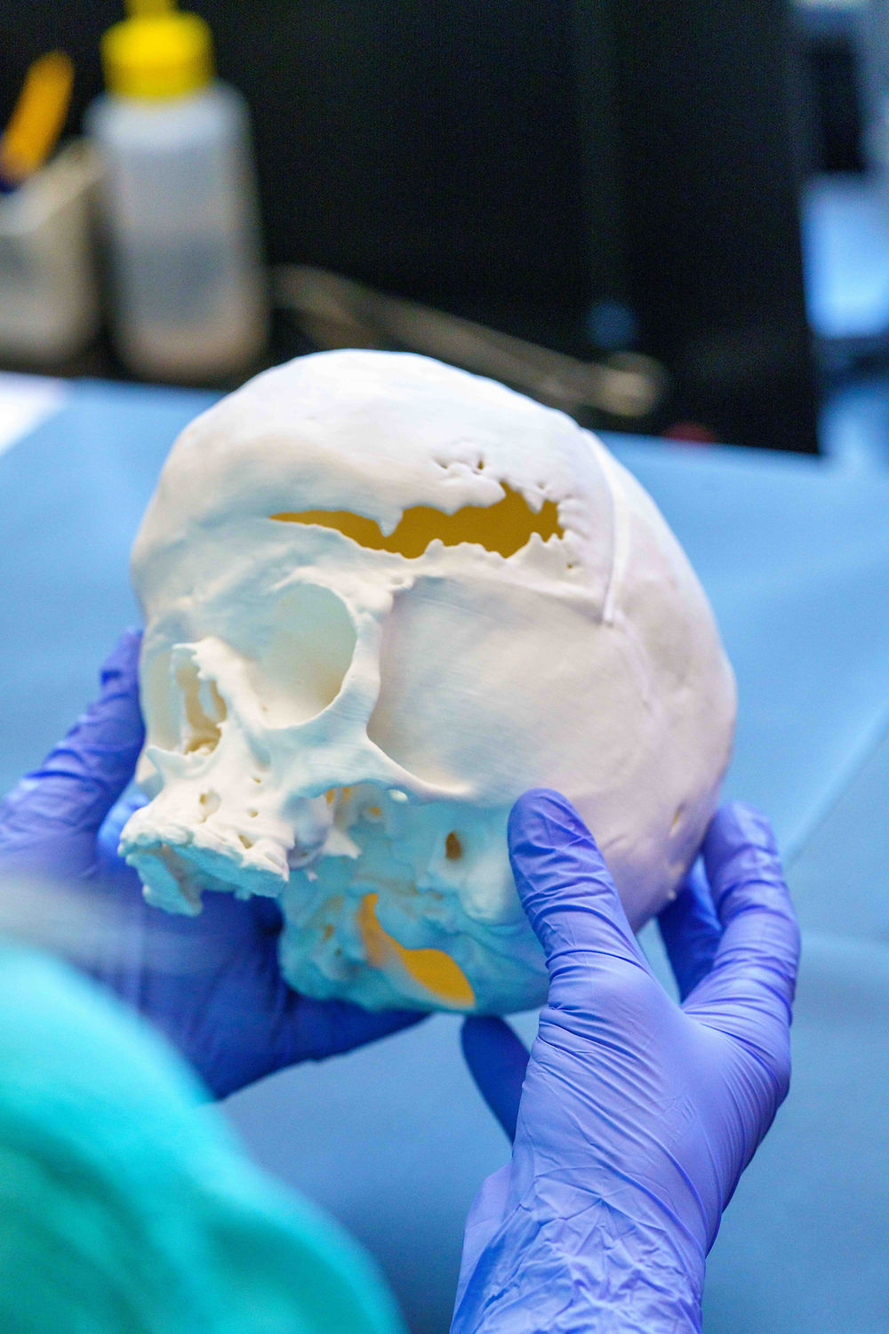 Skull model